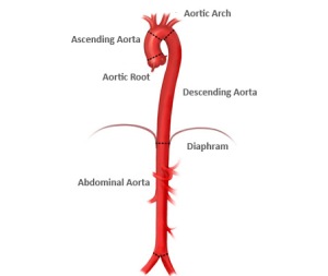 Aorta cu regiunile ei: aorta ascendentă, arcul aortei, aorta toracică descendentă și aorta abdominala